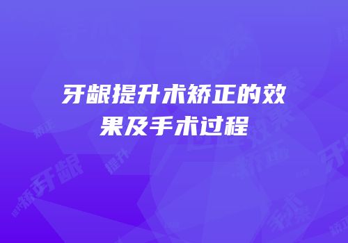 牙龈提升术矫正的效果及手术过程