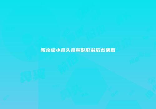 阳泉缩小鼻头鼻翼整形前后效果图