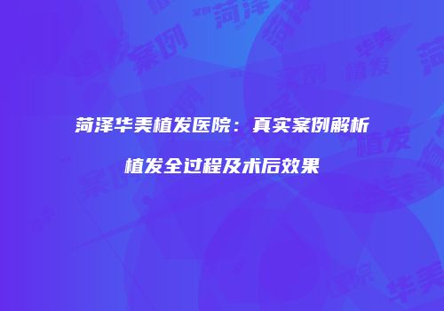 菏泽华美植发医院：真实案例解析植发全过程及术后效果