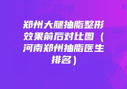 郑州大腿抽脂整形效果前后对比图（河南郑州抽脂医生排名）