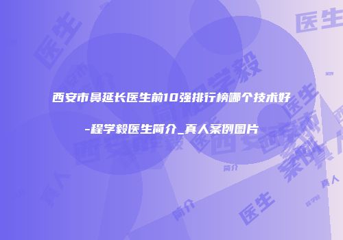 西安市鼻延长医生前10强排行榜哪个技术好-程学毅医生简介_真人案例图片