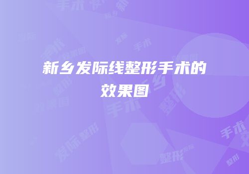 新乡发际线整形手术的效果图