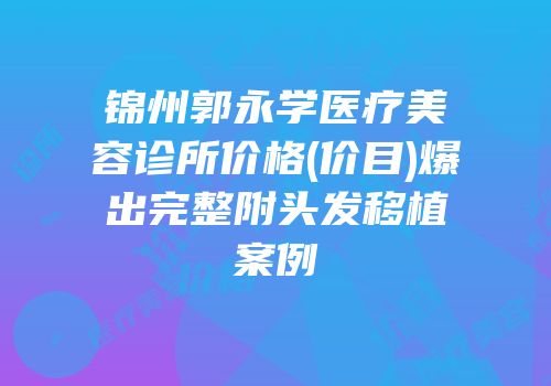 锦州郭永学医疗美容诊所价格(价目)爆出完整附头发移植案例