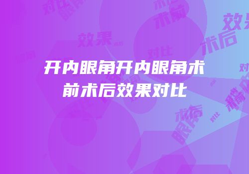 开内眼角开内眼角术前术后效果对比