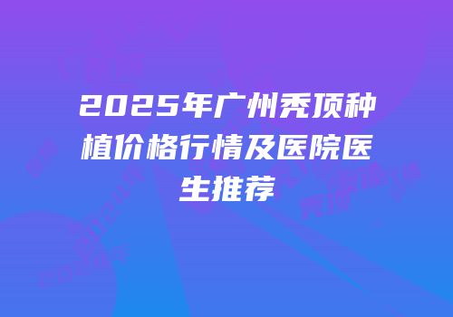 2025年广州秃顶种植价格行情及医院医生推荐