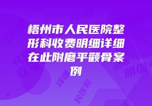 梧州市人民医院整形科收费明细详细在此附磨平颧骨案例