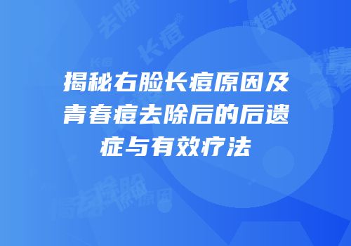 揭秘右脸长痘原因及青春痘去除后的后遗症与有效疗法