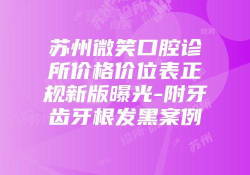 苏州微笑口腔诊所价格价位表正规新版曝光-附牙齿牙根发黑案例